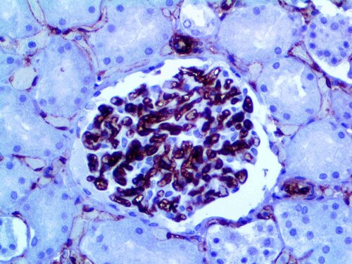 IHC of CD34 on an FFPE Kidney Tissue